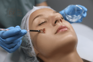 Descubra os melhores tratamentos para estrias e como eles podem ajudar a melhorar a aparência da sua pele. Conheça opções como o tratamento a laser, microagulhamento, peeling químico, radiofrequência e ácido retinoico. Na Clínica de Estética e Harmonização Facial, oferecemos uma equ