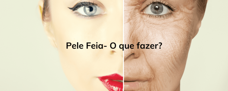 A pele sem brilho pode ser causada por uma série de fatores. A falta de hidratação adequada, a exposição excessiva ao sol sem proteção, o envelhecimento natural, a má alimentação e até a poluição ambiental podem contribuir para a aparência opaca da pele. Além disso, o acúmulo