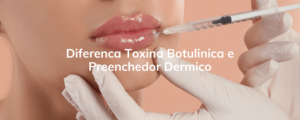 Diferenca Toxina Botulinica e Preenchedor Dermico