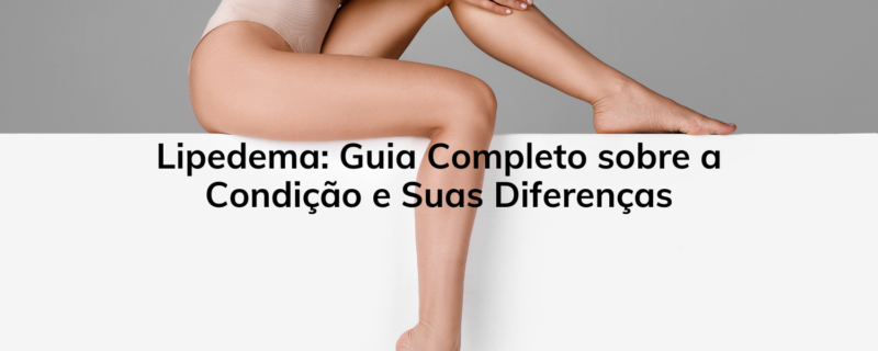 Lipedema: Entenda a condição e suas diferenças".