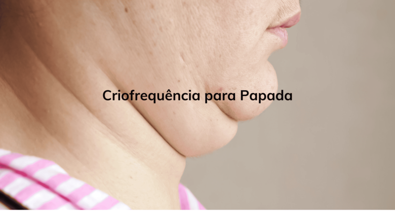 Criofrequência para Papada