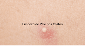 Limpeza de Pele nas Costas