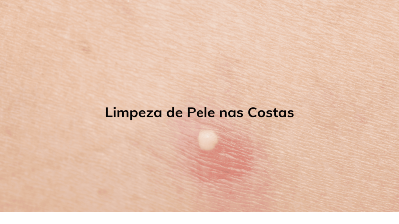 Limpeza de Pele nas Costas