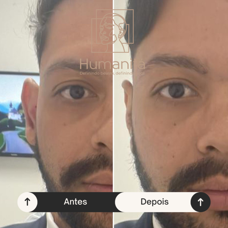 O que é a Otomodelação?