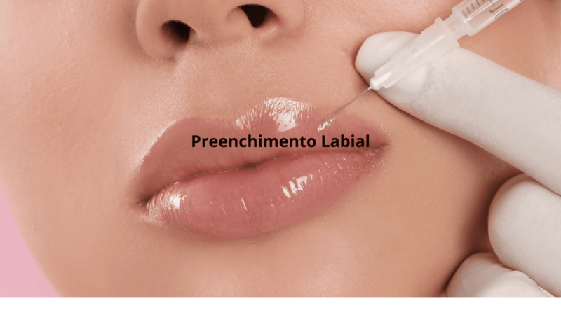 Preenchimento Labial