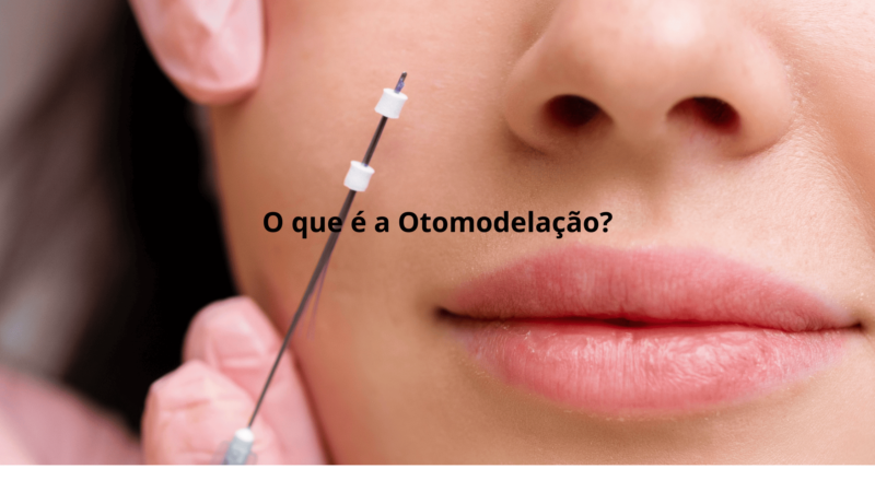 O que é a Otomodelação?