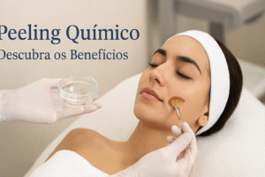 Peeling Químico: Descubra os Benefícios